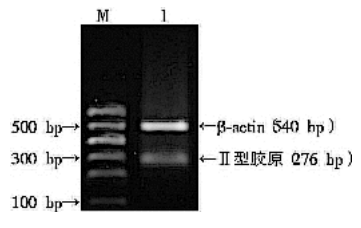 電泳結(jié)果2